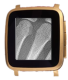 X-Ray
