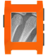 X-Ray