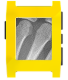 X-Ray