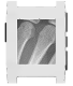 X-Ray