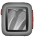 X-Ray