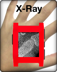X-Ray