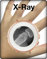 X-Ray